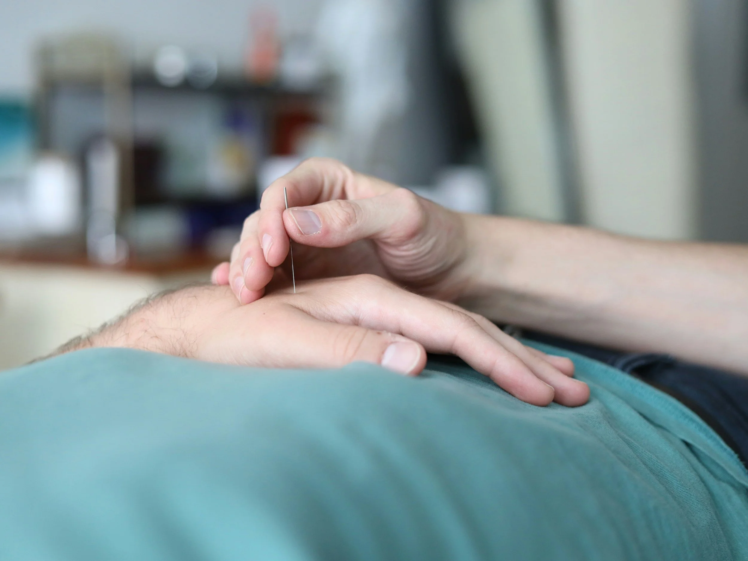 Acupuncture for Anxiety in Toronto