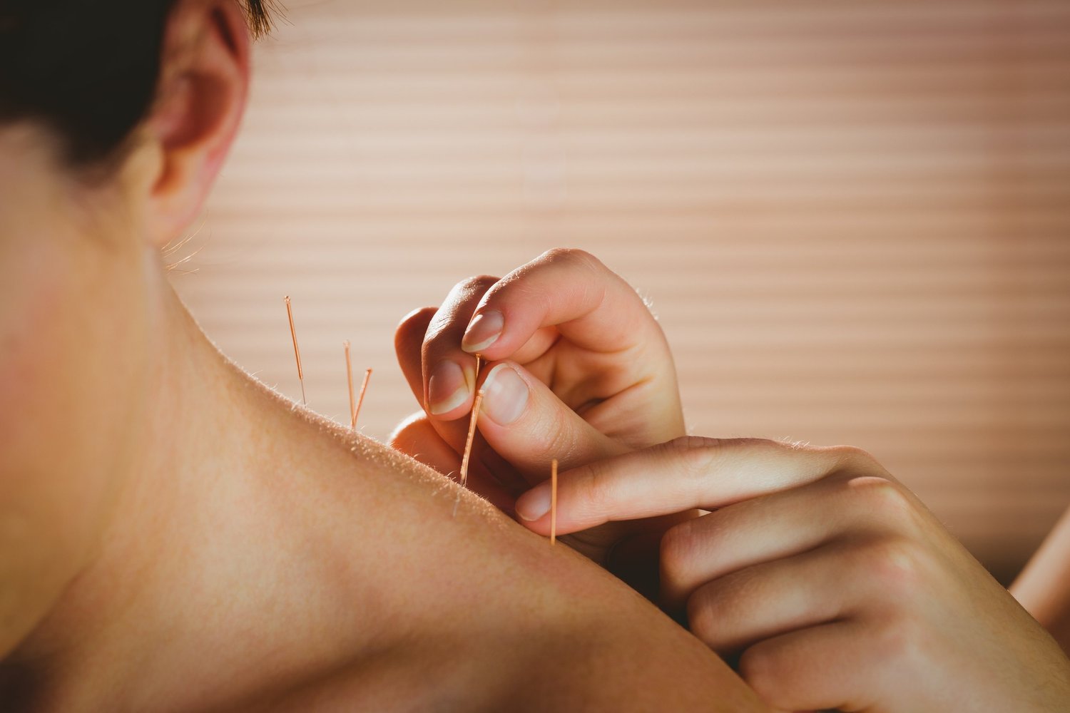 Acupuncture near me in toronto